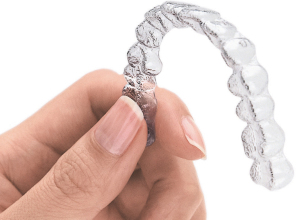Invisalign Brescia Dott.ssa Chiavassa